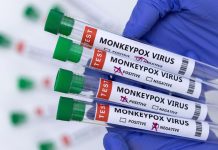 Monkeypox spreads to 30 states, cases hit 277