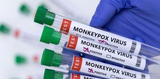 Monkeypox spreads to 30 states, cases hit 277
