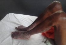 NGO Appeals to President Tinubu for Financial Rescue of Retired Police Officer Injured on Duty